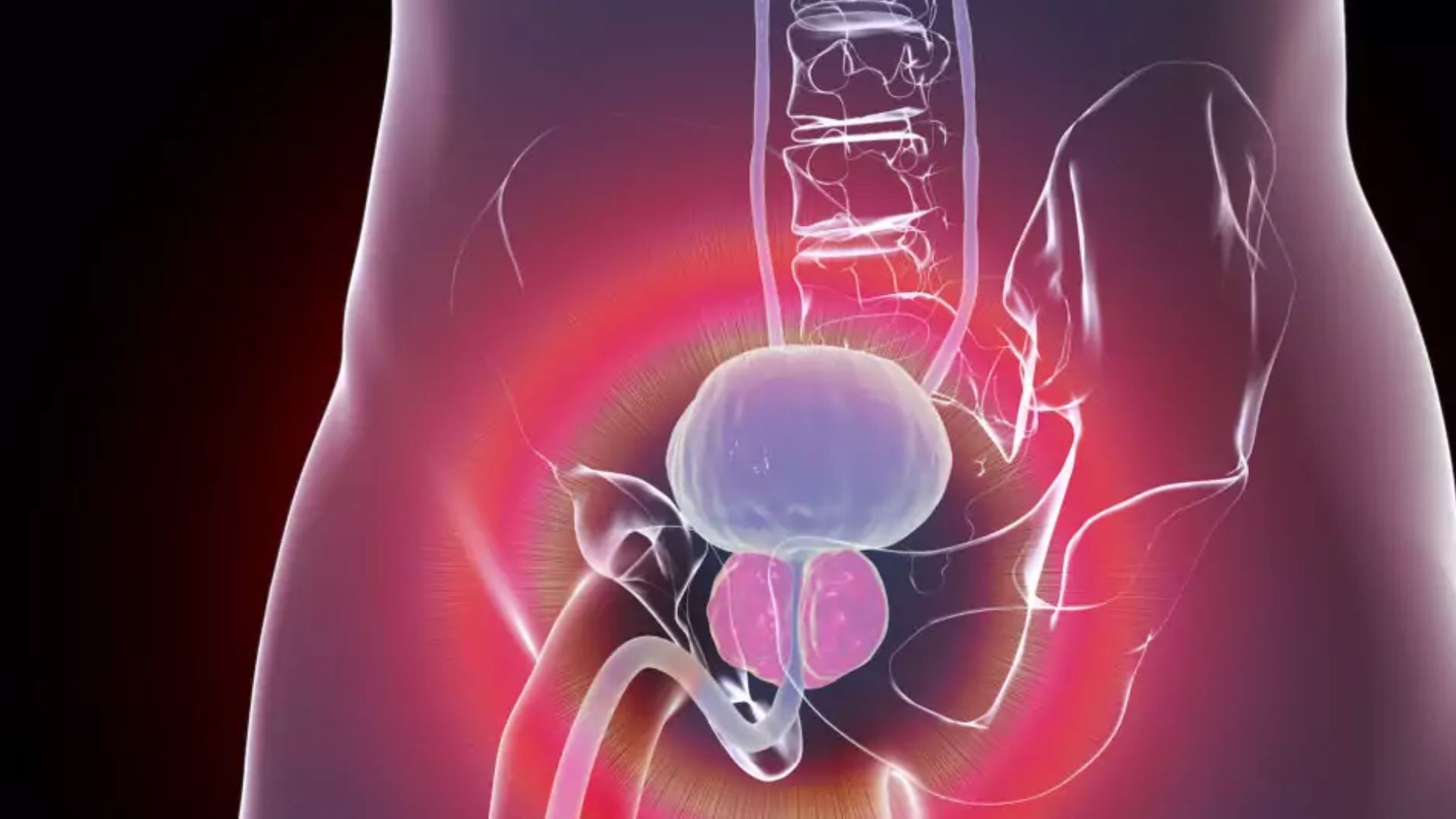 What is BPH? A Complete Guide to Enlarged Prostate